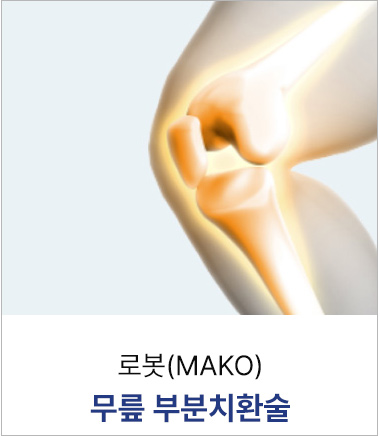 로봇(MAKO)무릎 부분전치환술