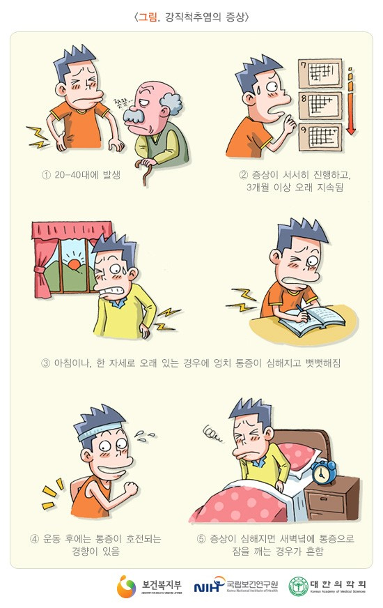 강직성 척추염 증상 / 출처 : 보건복지부