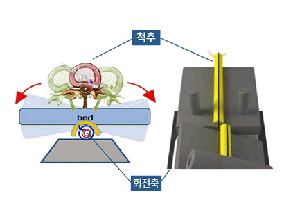 기존 감압치료기와의 차이점