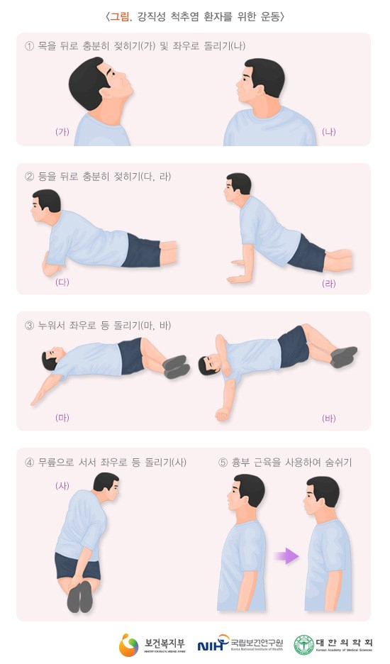 강직성 척추염 환자를 위한 운동 / 출처 : 보건복지부