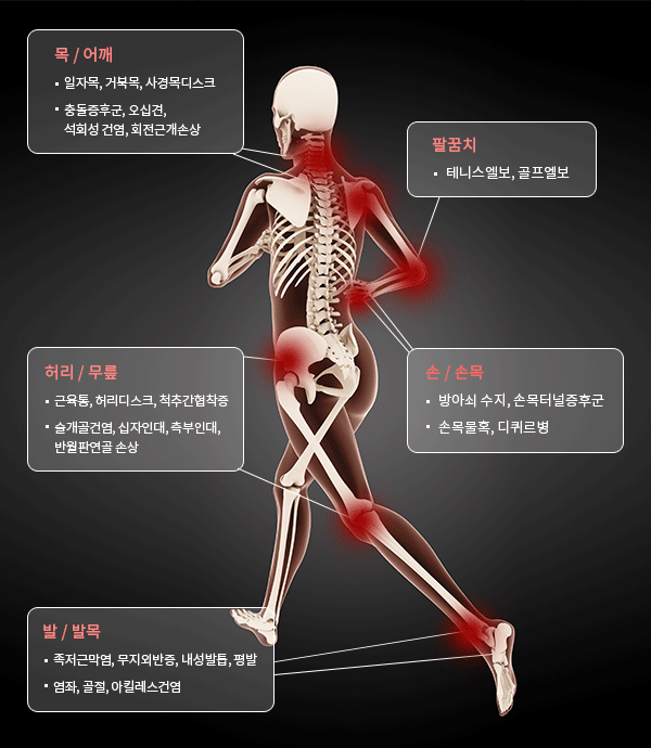 체외충격파치료 효과 부위