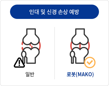 기존 인공관절수술과 로봇 인공관절수술의 차이점