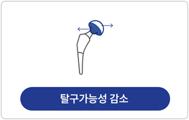 탈구가능성 감소